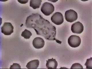 백혈구가 박테리아 잡는 모습.gif 사진